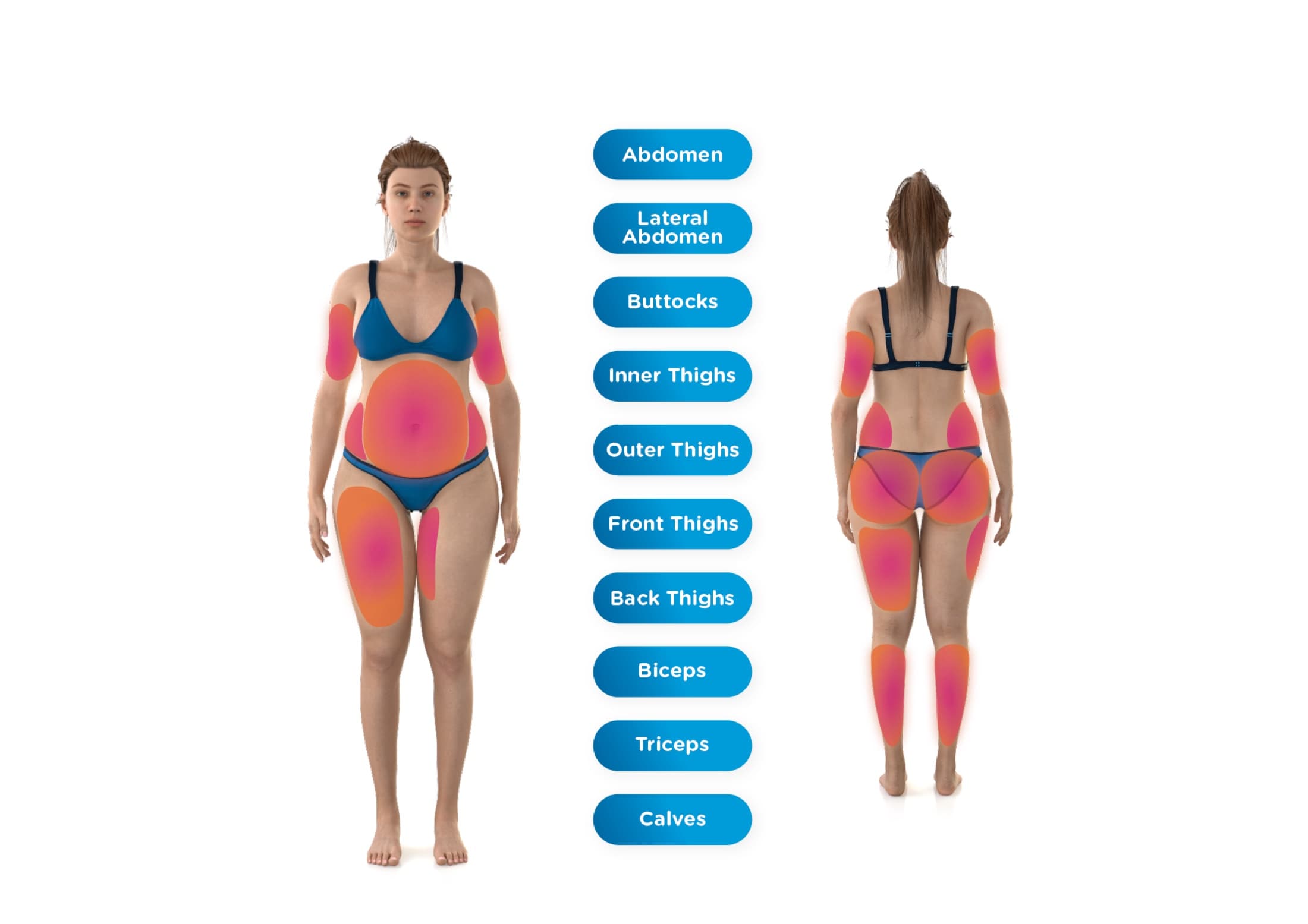 Body diagram showing the ten EMSCULPT NEO treatment areas — abdomen, buttocks, flanks, thighs (front, back, inner, outer), arms, calves, and back.